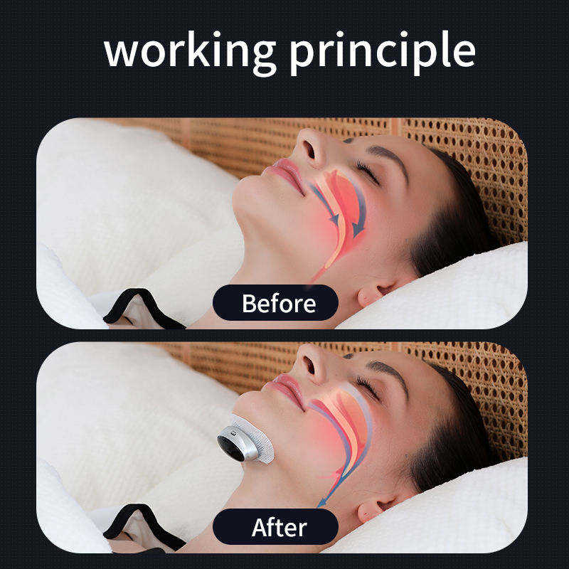 Thermal imaging showing restricted airway during snoring, causing vibration and sound.