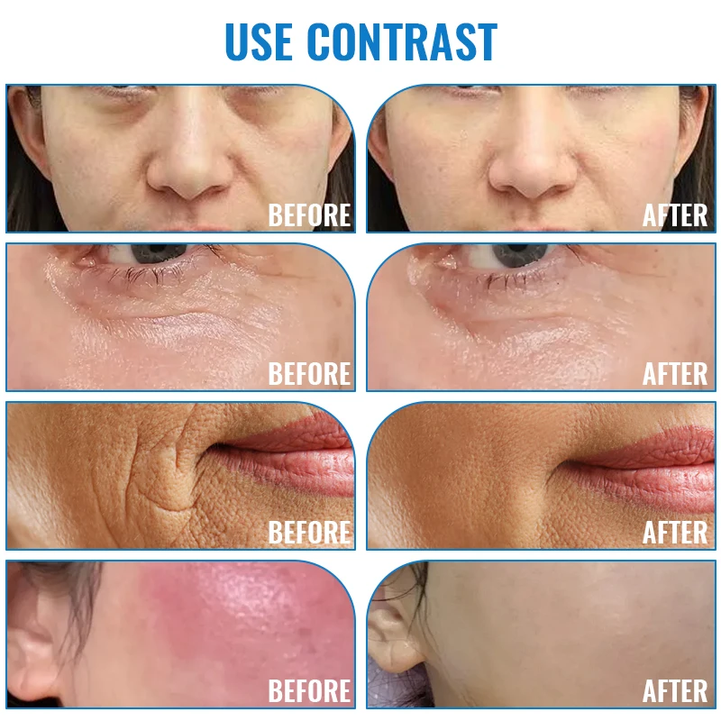 Serum residue left on a tissue after hand application